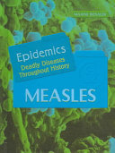 Measles cover
