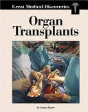 Organ Transplants cover