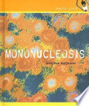 Mononucleosis cover