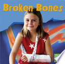 Broken Bones cover