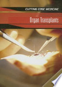 Organ Transplants cover