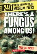 There's a Fungus Among Us! True Stories of Killer Molds cover