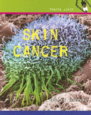 Skin Cancer cover