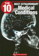 The 10 Most Extraordinary Medical Conditions cover