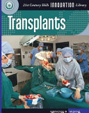 Transplants cover