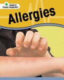 Allergies (Smart Apple Media) cover