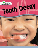 Tooth Decay (Smart Apple Media) cover