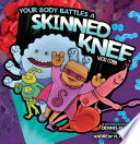 Your Body Battles a Skinned Knee cover