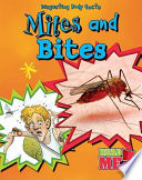 Mites and Bites cover