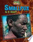 Smallpox: Is It Over? cover