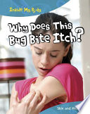Why Does This Bug Bite Itch? Skin and Healing cover