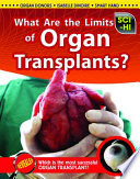 What Are the Limits of Organ Transplants? cover