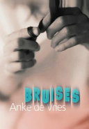 Bruises cover