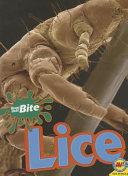 Lice cover