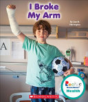 I Broke My Arm cover