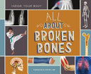 All About Broken Bones cover