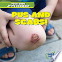 Pus and Scabs! cover