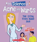 The Science of Acne and Warts: The Itchy Truth About Skin cover