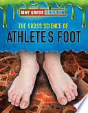 The Gross Science of Athlete’s Foot cover