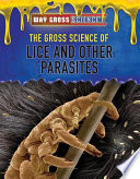 The Gross Science of Lice and Other Parasites cover
