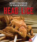 What You Need to Know About Head Lice cover