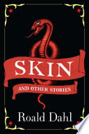 Skin and Other Stories cover