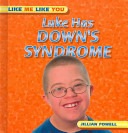 Luke Has Down's Syndrome cover