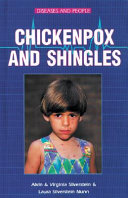 Chickenpox and Shingles cover