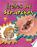 Itches and Scratches cover