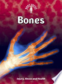 Bones (Revised Edition) cover