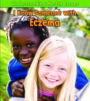 I Know Someone with Eczema cover
