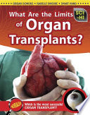 What Are the Limits of Organ Transplants? cover