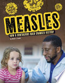 Measles: How a Contagious Rash Changed History cover
