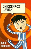 Chickenpox...Yuck! cover
