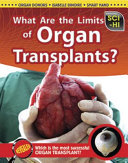 What Are the Limits of Organ Transplants? cover