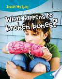 What Happens to Broken Bones? Bones cover