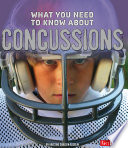 What You Need to Know About Concussions cover
