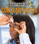 What You Need to Know About Conjunctivitis cover
