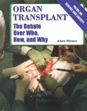 Organ Transplant: The Debate Over Who, How, and Why cover