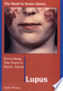 Everything You Need to Know About Lupus cover