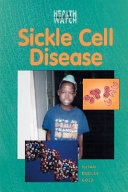 Sickle Cell Disease cover