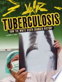 Tuberculosis: How the White Death Changed History cover
