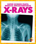 X-rays cover