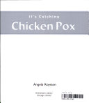 Chicken Pox cover