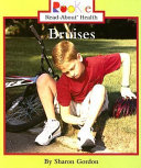 Bruises cover