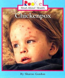 Chickenpox cover