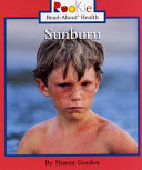 Sunburn cover