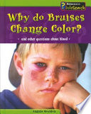 Why Do Bruises Change Color? And Other Questions About Blood cover