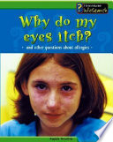 Why Do My Eyes Itch? And Other Questions About Allergies cover