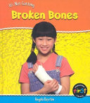 Broken Bones cover